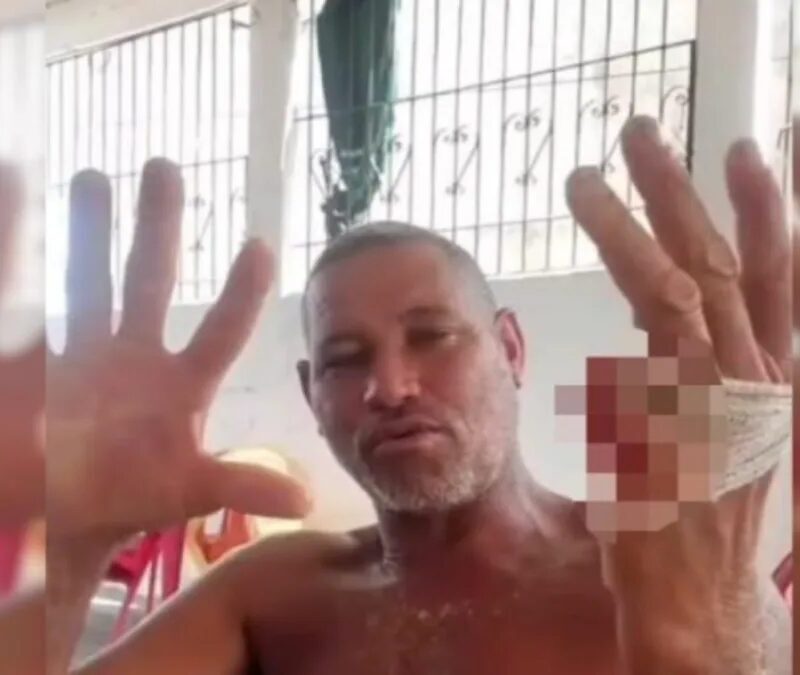 Morador da Bahia grava vídeo com dedo cortado e cita eleição de Lula