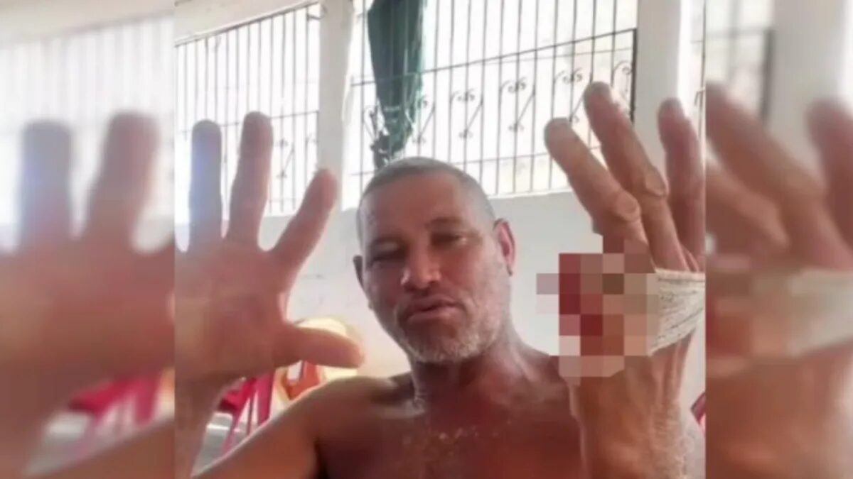Homem aparece com dedo mindinho cortado e cita promessa pela vitória de Lula